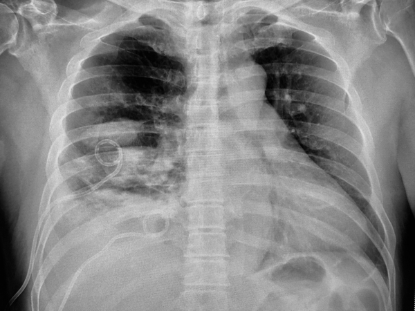 Radiology